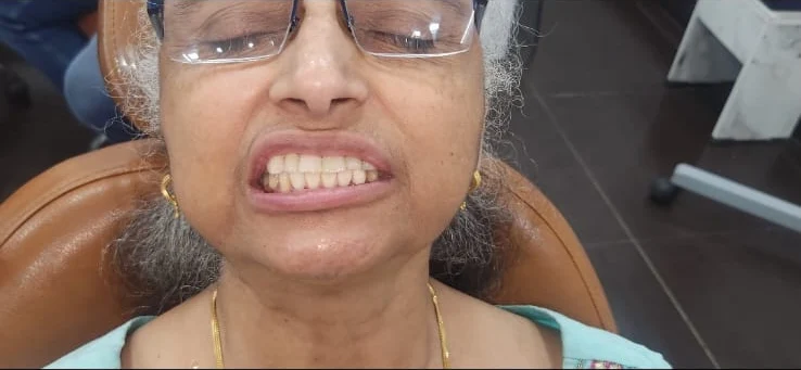 A patient showing her restored smile