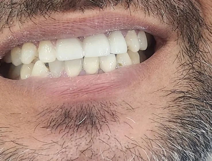 A patient's restored smile